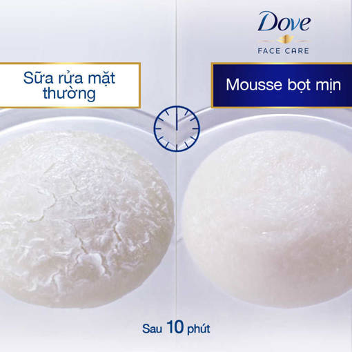 Picture of Sữa Rửa Mặt Dạng Bọt Dove Tinh Chất - Serum Cấp Ẩm & Cho Da Mềm Mượt 130g