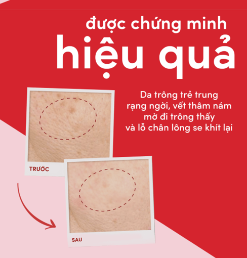 Ảnh của Kem Dưỡng Pond's Ngăn Ngừa Lão Hóa Ban Đêm 50g